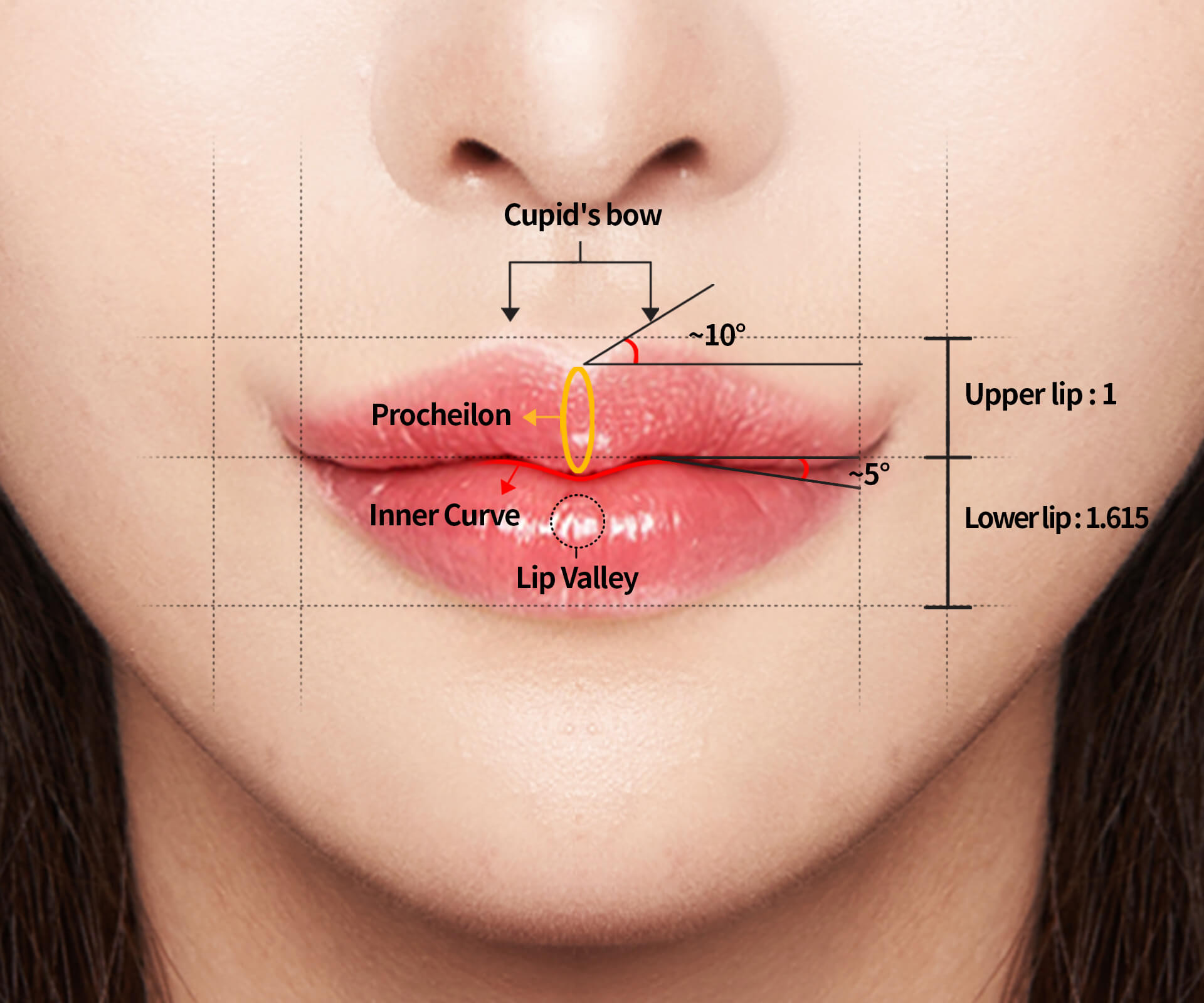 cupid-s-bow-surgery-secret-to-korean-lips-hyundai-aesthetics-blog