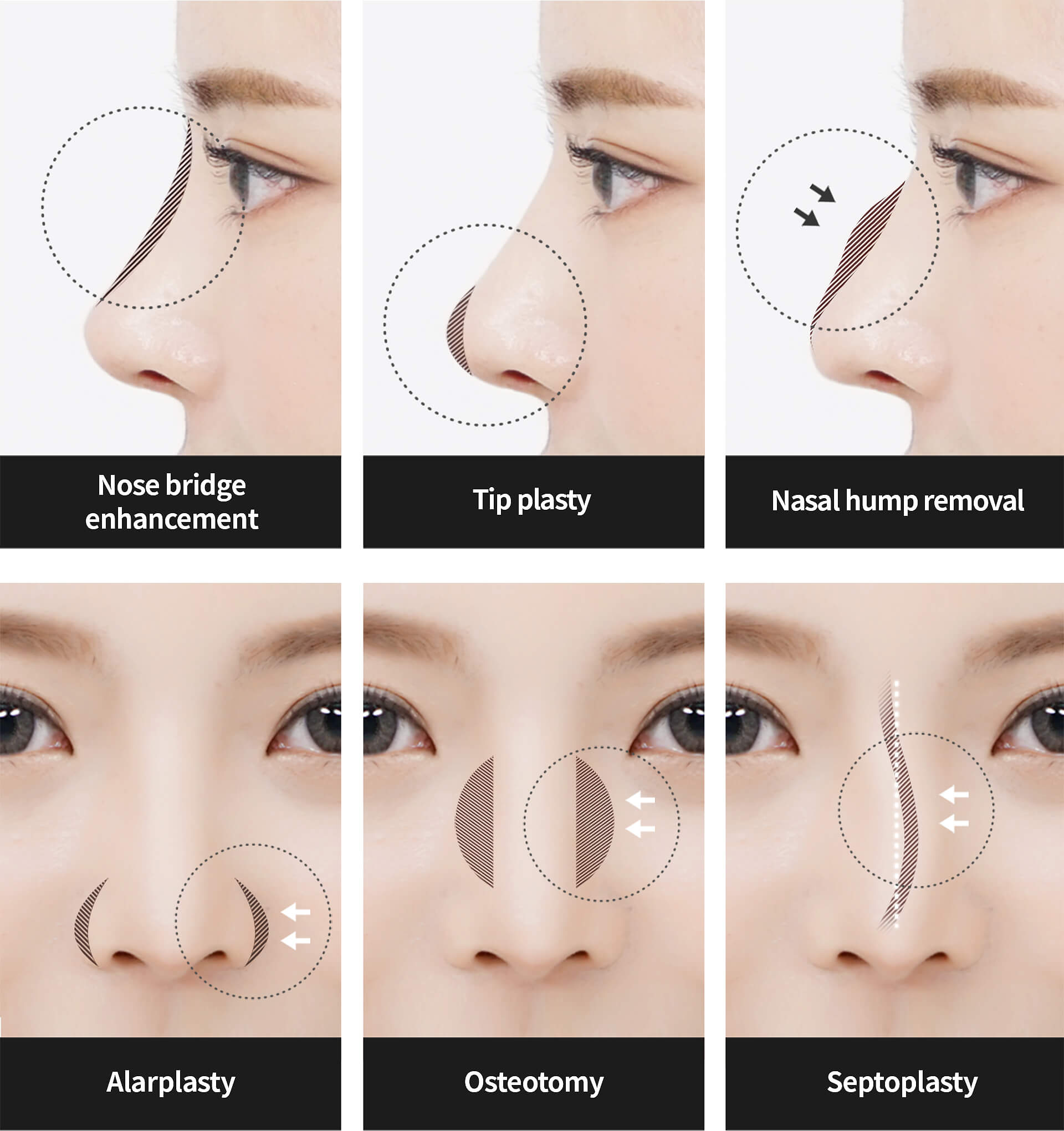 Nose shapes are similar to any other body part: Greek nose, roman nose, cel...