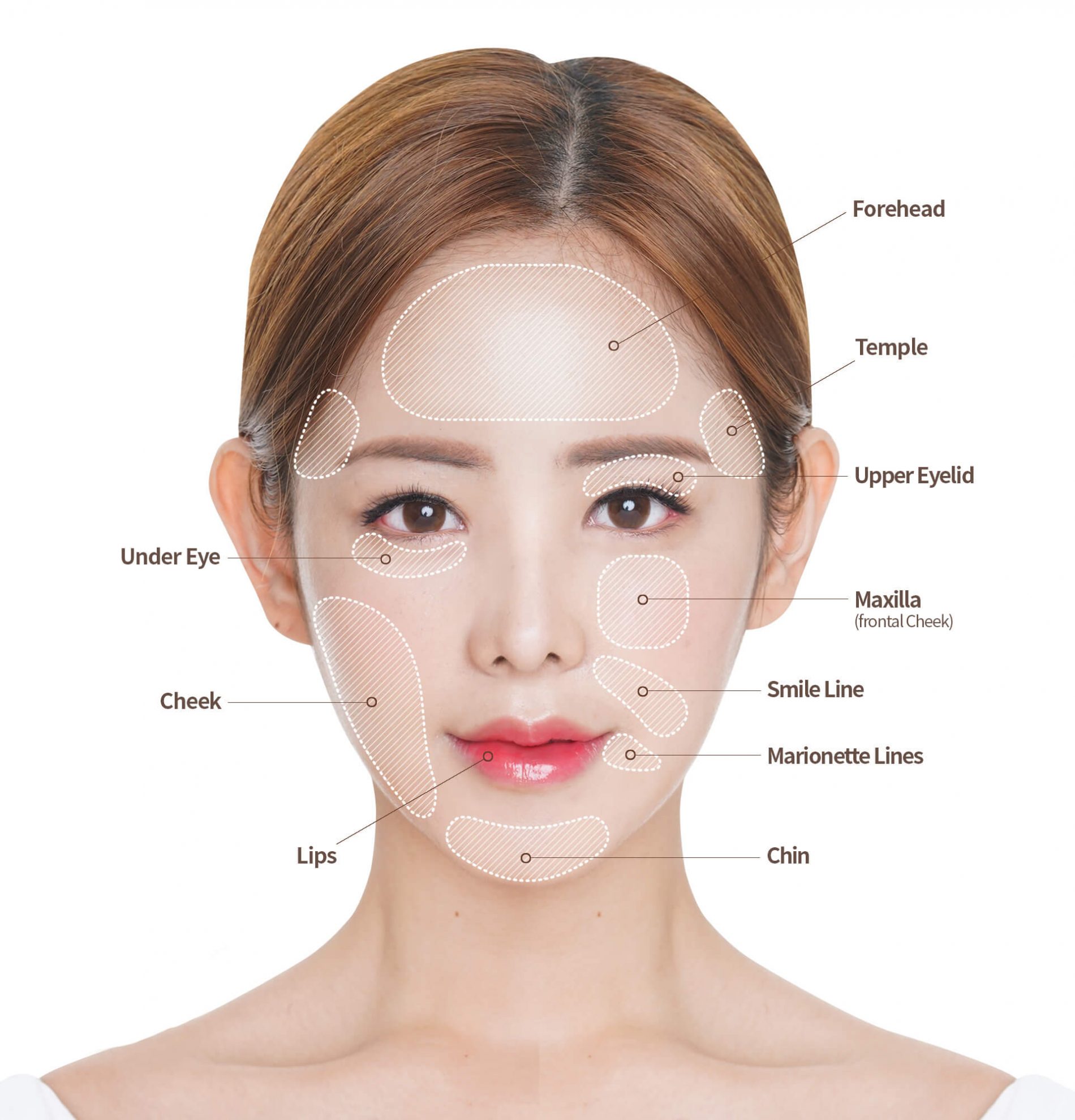 Everything about facial fat grafting in Korea - Hyundai Aesthetics Blog