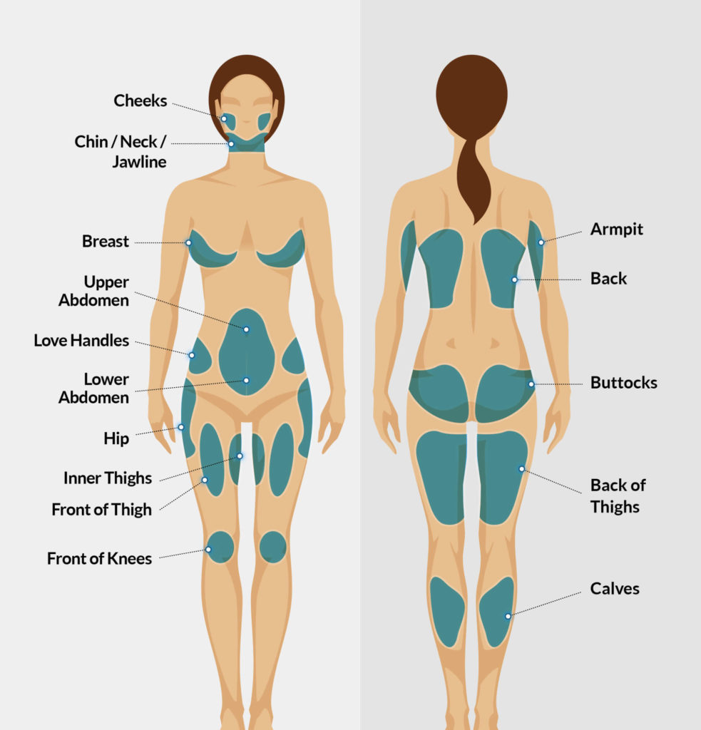 Facts about liposuction surgery in Korea - Hyundai Aesthetics Blog