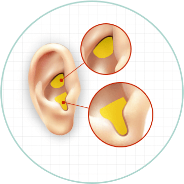 Ear cartilage | Hyundai Aesthetics Plastic Surgery